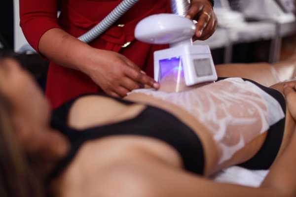 Get Your Dream Body with Non-Invasive Fat Freezing Sidcup