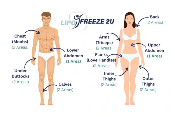 Areas you can have fat freezing treatment Sidcup