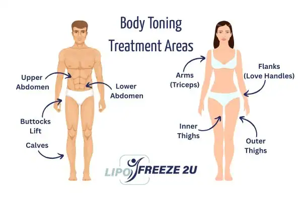 Graphic showing where you can have Body toning Treatment Sidcup on your body