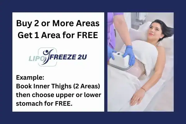 fat freezing prices Sidcup