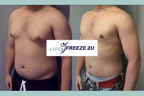 How Long Does It Take to See Results Sidcup?