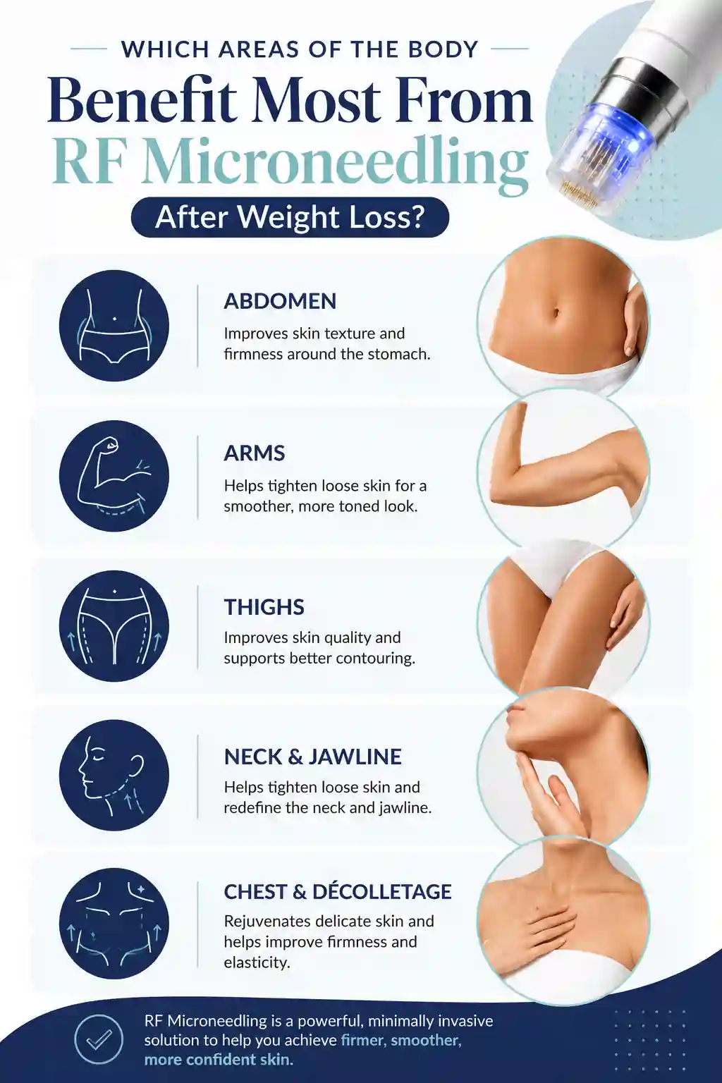 Which Areas of the Body Benefit Most From RF Microneedling After Weight Loss Sidcup